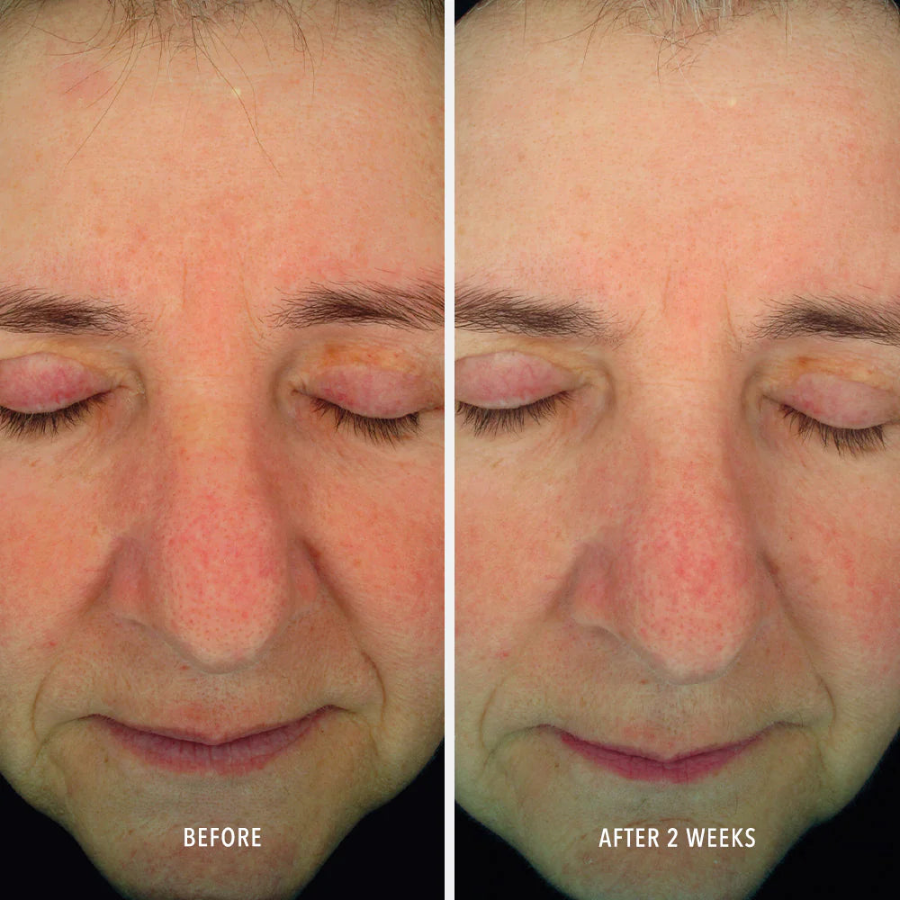 SOOTHING SERUM Redness Repair & Relief, Hydropeptide, 30 ml