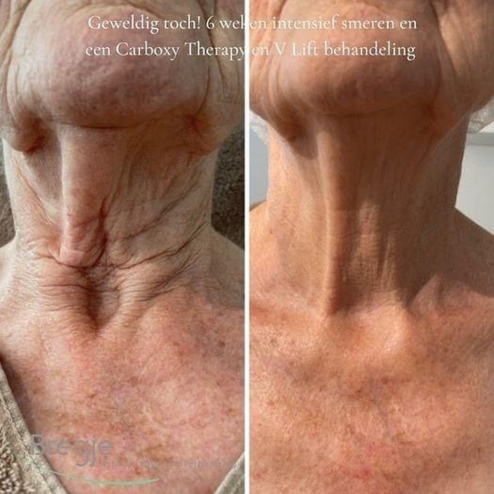 krx-prod-neck-lift-cream-5_ua-1000x1000-1000x1000.jpg