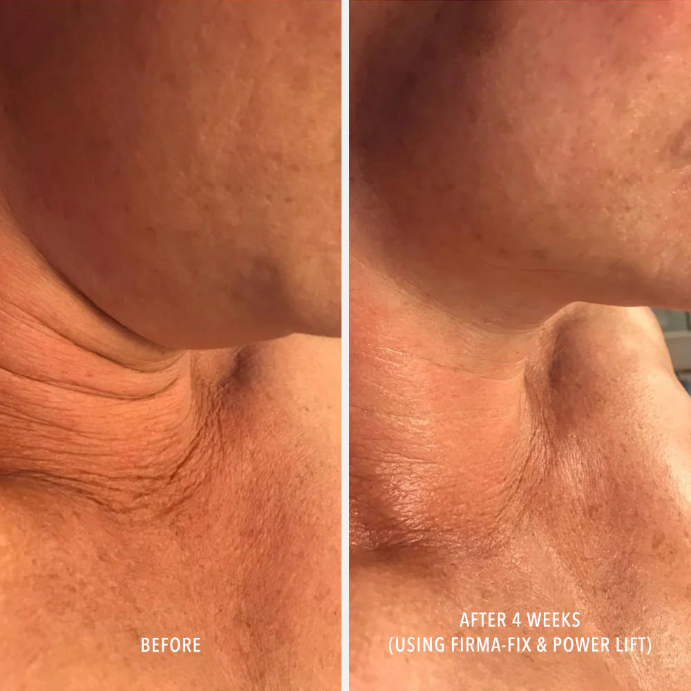 FIRM A FIX NECTAR Lifting Neck & Décolleté Serum, Hydropeptide, 50 ml