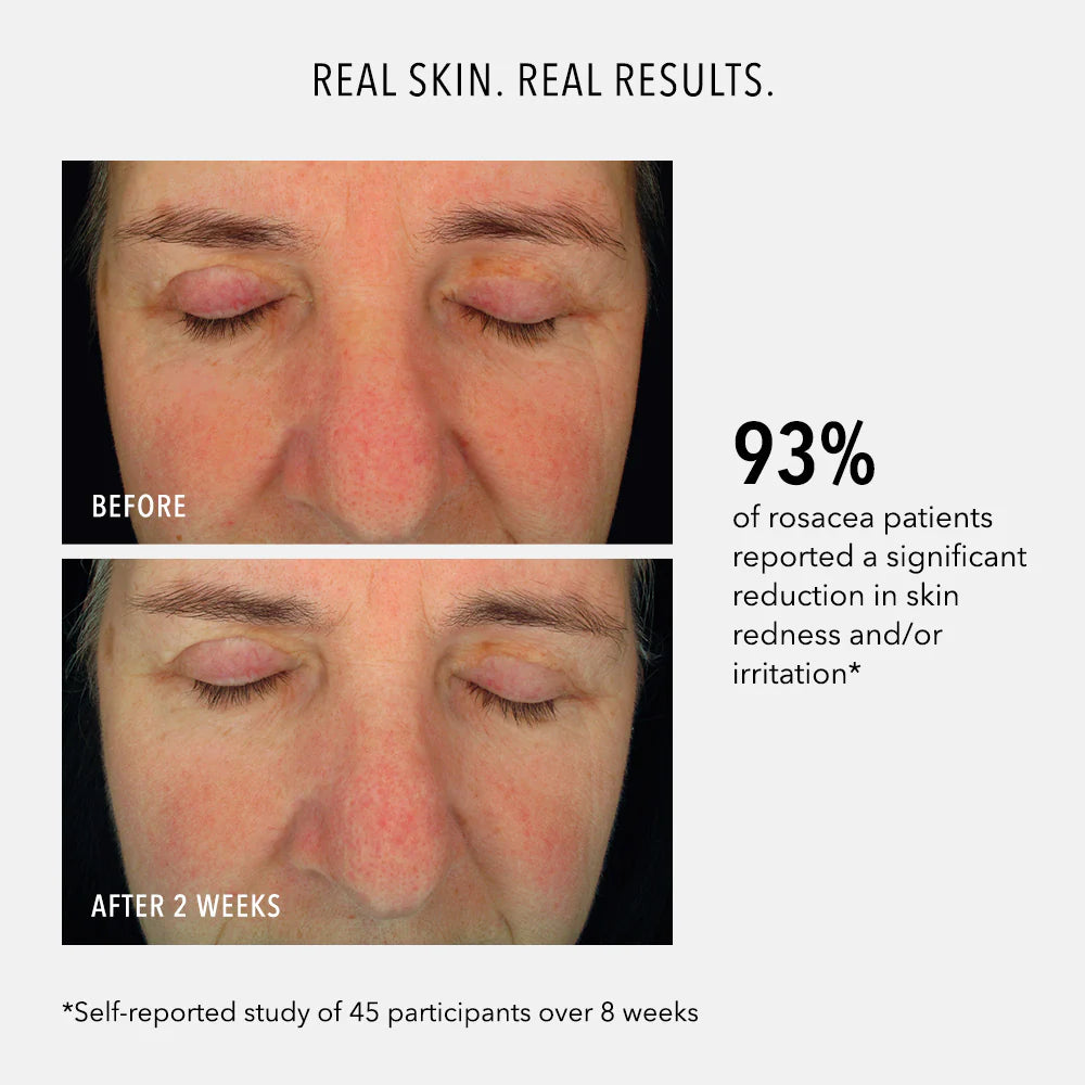 SOOTHING SERUM Redness Repair & Relief, Hydropeptide, 30 ml