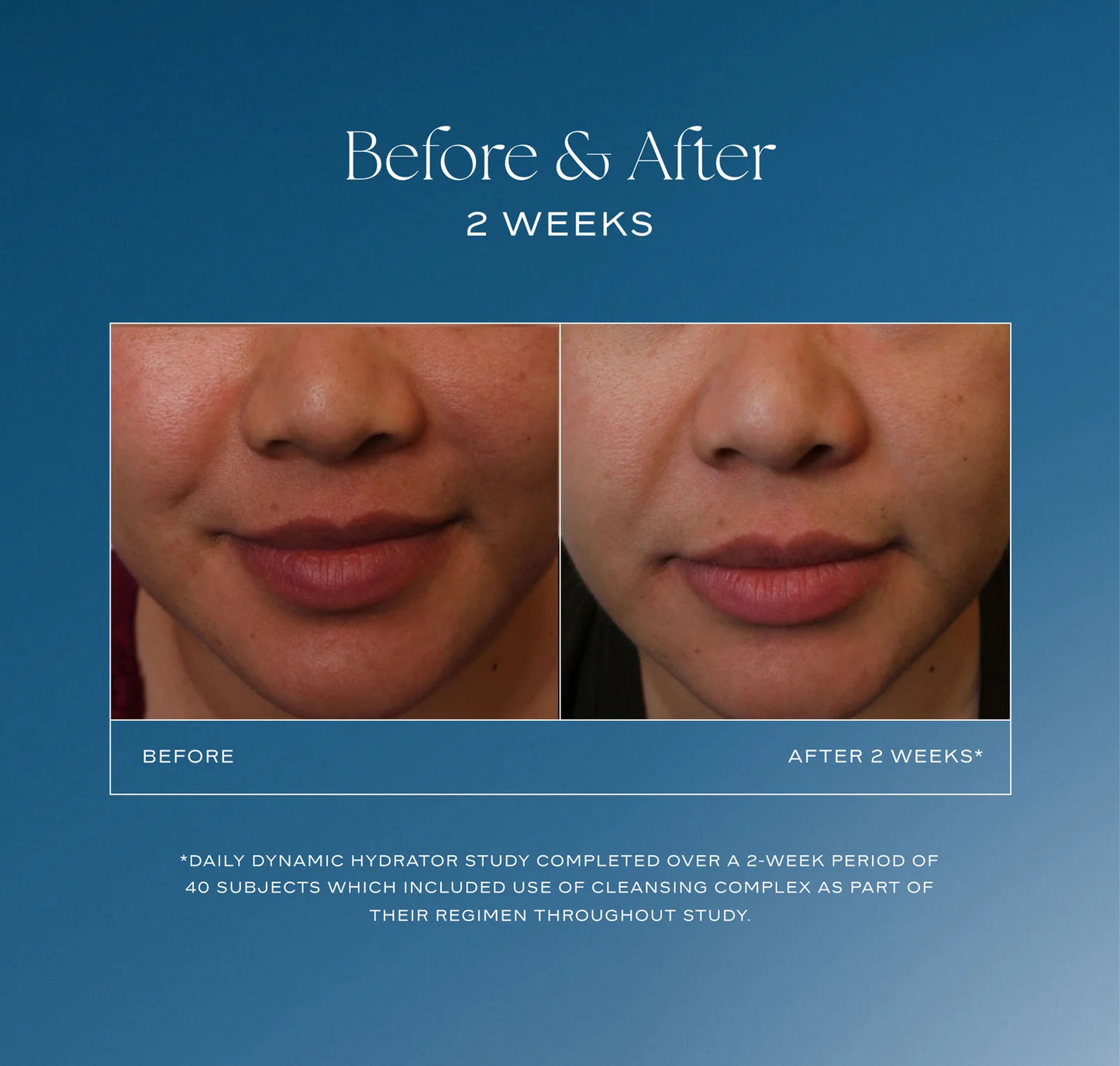 DAILY DYNAMIC HYDRATOR, Is Clinical, 50 ml