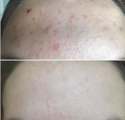 8% Mandelic 3-in-1 Serum, Vivant, 30 ml