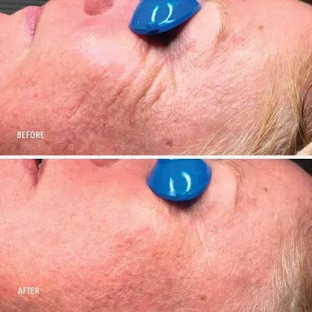 COLLAGEN REACTIVATE PM, Супер мощный ночной антивозрастной крем Nimni, Hydropeptide, 30 мл